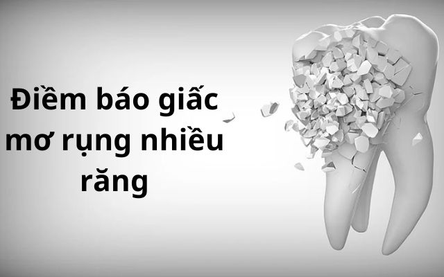 [Giải Mã] Mơ Rụng Răng Đánh Số Gì Trúng Thưởng 100%