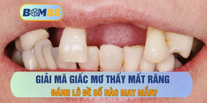 Giấc Mơ Thấy Mất Răng Điềm Báo Gì, Đánh Số Nào Khi Chơi Lô Đề?